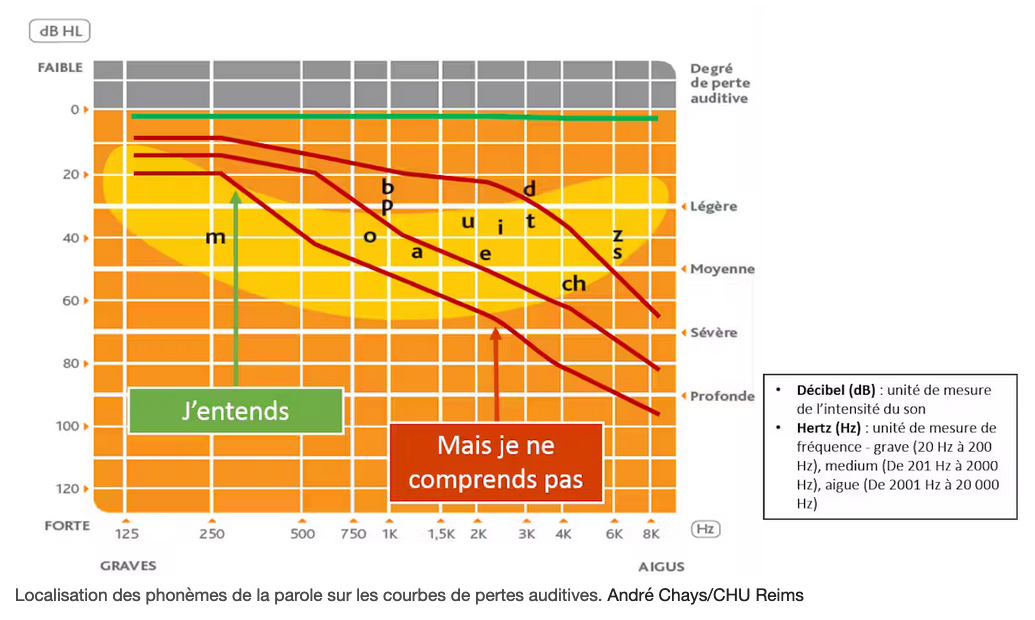  Localisation des phonèmes de la parole sur les courbes de pertes auditives. André Chays/CHU Reims 
